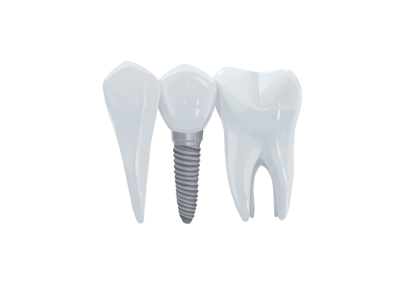 implant dentaire zircone